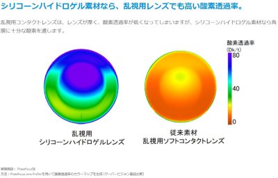 画像2: マイデイトーリック　【要処方箋または指示書】